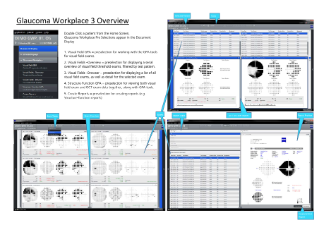 Preview image of Glaucoma Workplace 3 Overview
