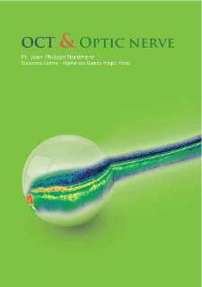 Preview image of OCT & Optic Nerve: Interpretation Book