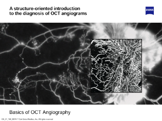 Preview image of Basics of OCT Angiography