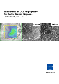 Preview image of The Benefits of OCT Angiography for Ocular Disease Diagnosis