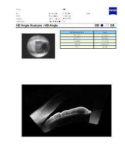 Preview image of For Anterior Segment