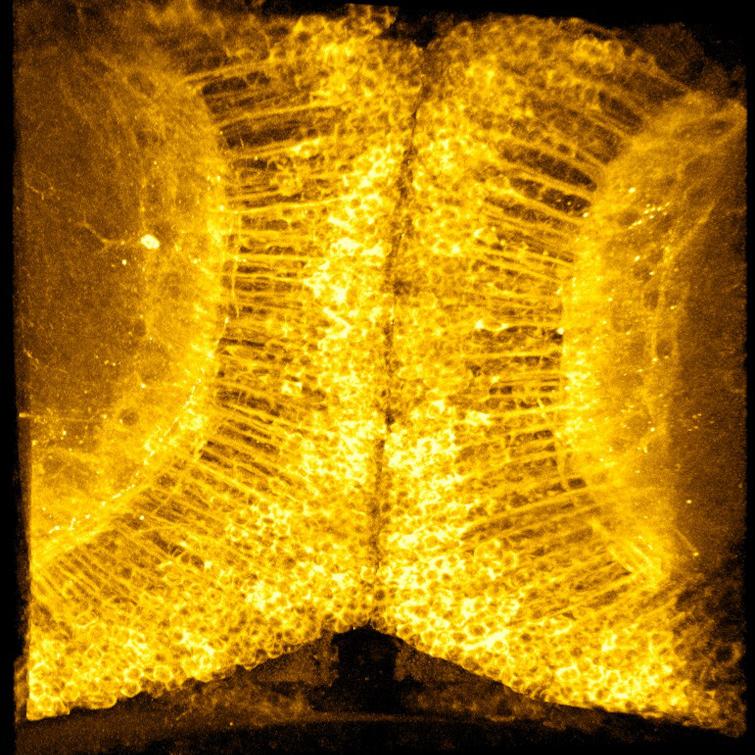 Zebrafish Neuron