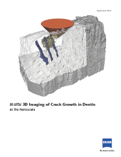 Preview image of In situ 3D Imaging of Crack Growth in Dentin