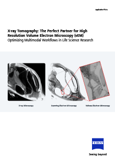 Preview image of X-ray Tomography: The Perfect Partner for High Resolution Volume Electron Microscopy (vEM)