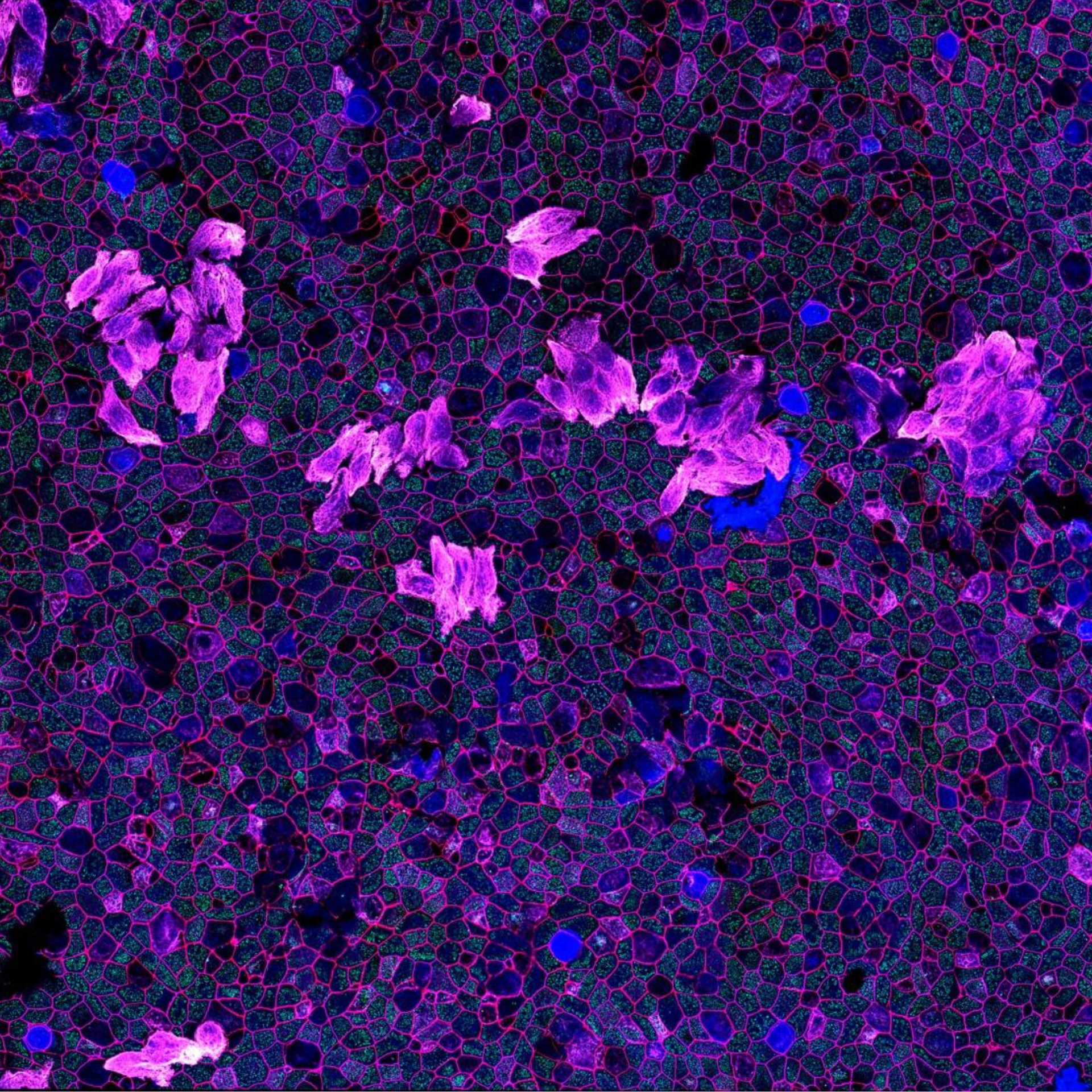 Murine Lung