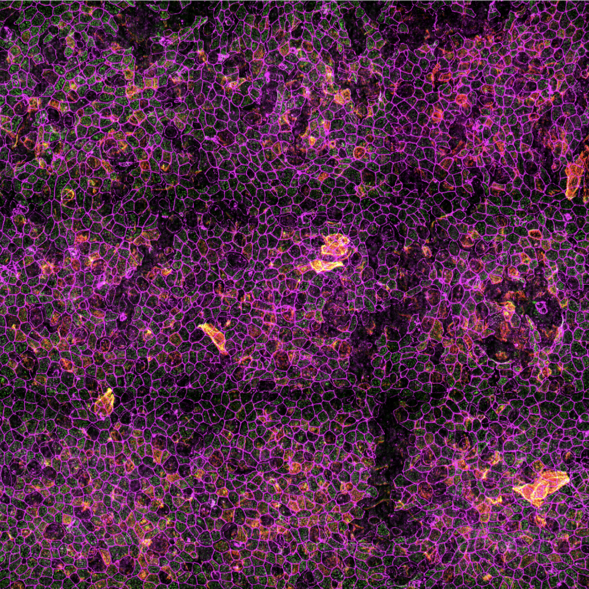 Airway epithelium captured with Lattice SIM Apotome Mode (x25). Courtesy of Dr. Vito Mennella, Queen Mary University.