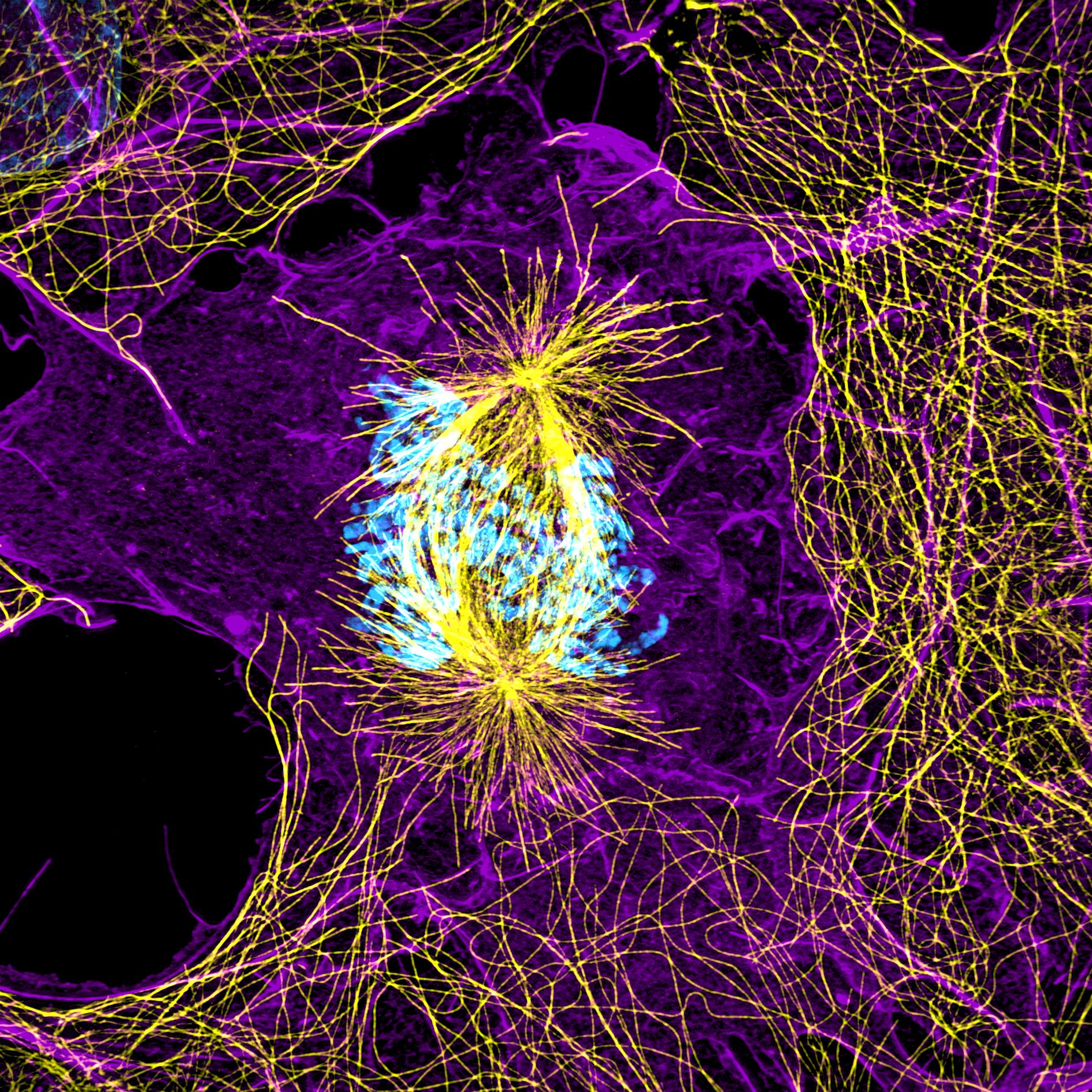 Image captured with ZEISS ELYRA. Lattice SIM: Comparison of widefield and Lattice SIM images of a Cos-7 cell undergoing mitosis stained for actin (Phalloidin Alexa Fluor 568, magenta), microtubules (anti-beta-tubulin Alexa Fluor 488, yellow) and nucleus (Hoechst, blue). Images are maximum intensity projections of 30 planes of a total depth of 3.19 µm. Objective: Plan-Apochromat 63×/1.4 Oil