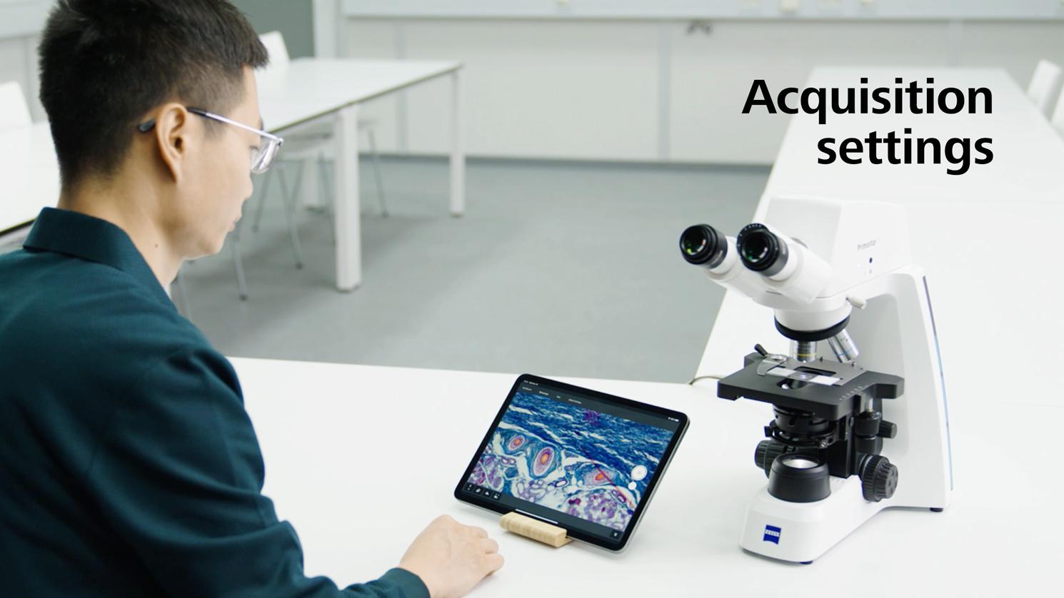 Acquisition settings