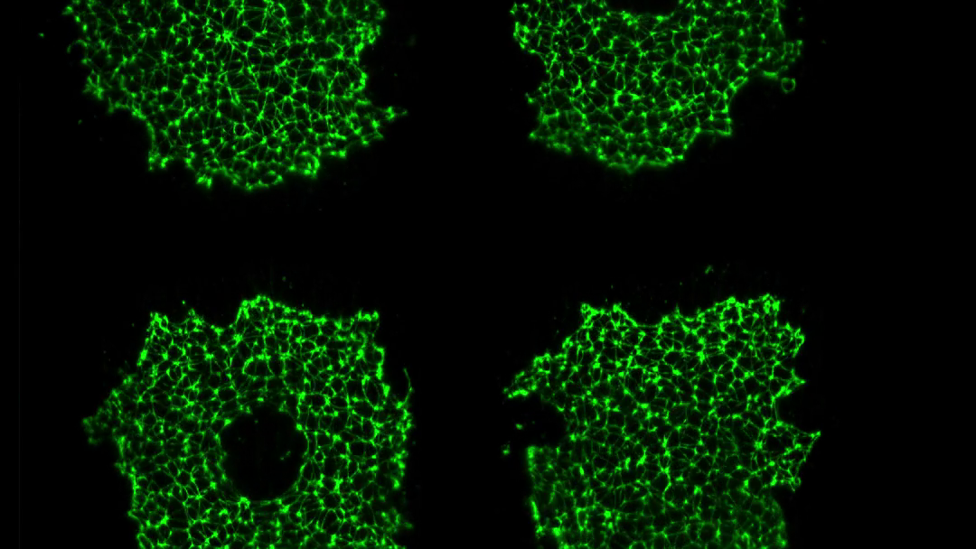 Stem cell colonies - 16hrs time lapseImage courtesy: Giridhar Anand, Ramanathan Lab, Harvard University, Cambridge, US