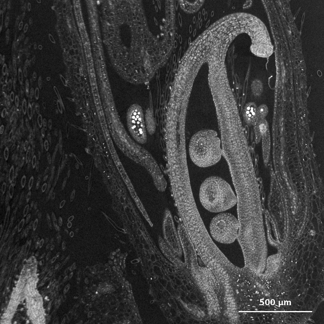 A soybean Scout and Zoom scan of a developing floral complex. 
