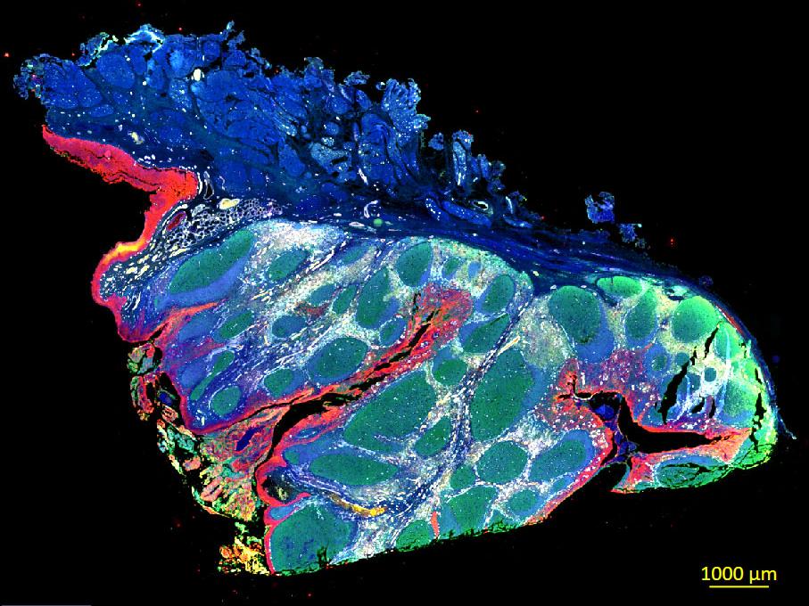 Tonsil sample acquired with ZEISS Axioscan 7 clinical