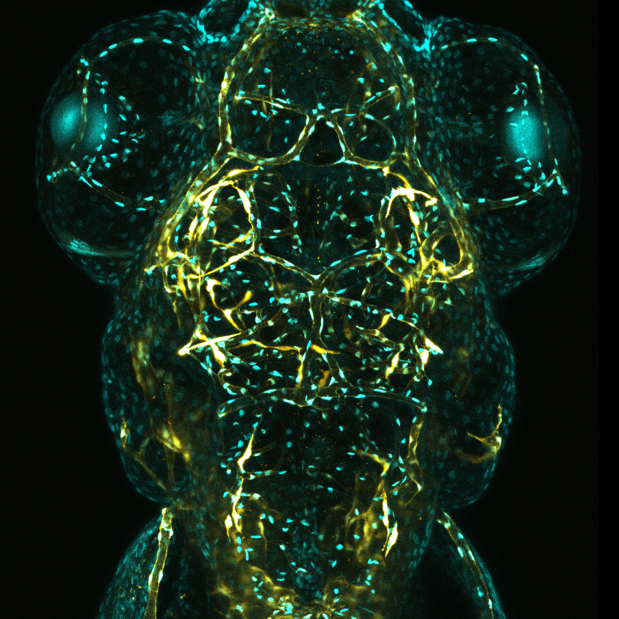 Courtesy of Okuda Kazuhide Shaun. Cerebral vessels in zebrafish imaged with ZEISS confocal microscopy. 