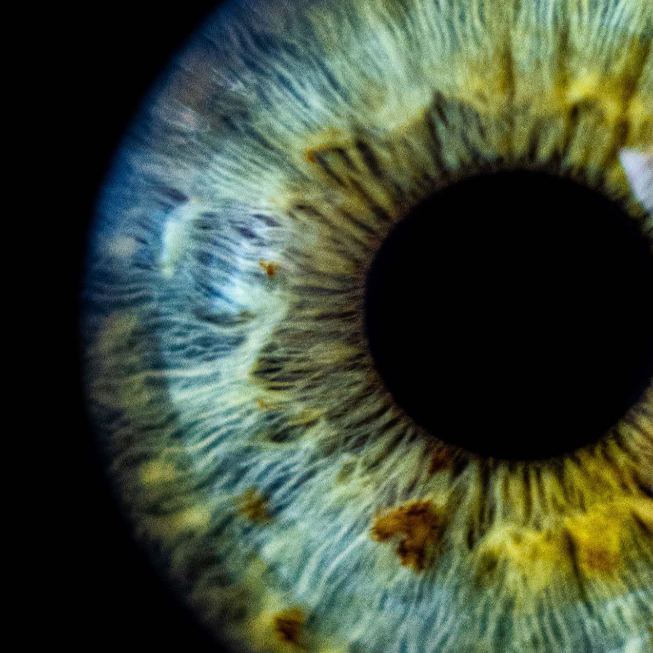 A close up of an eye.