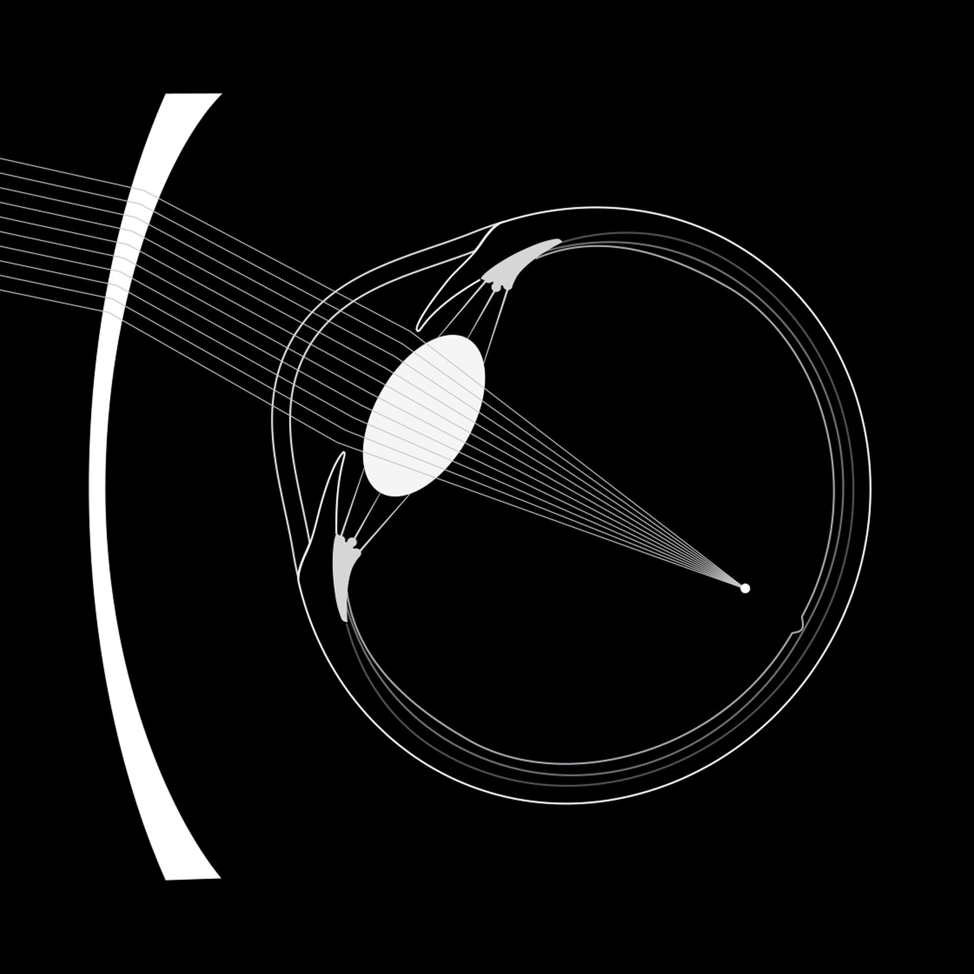 Minus Vision Examples ZEISS ClearMind lens portfolio