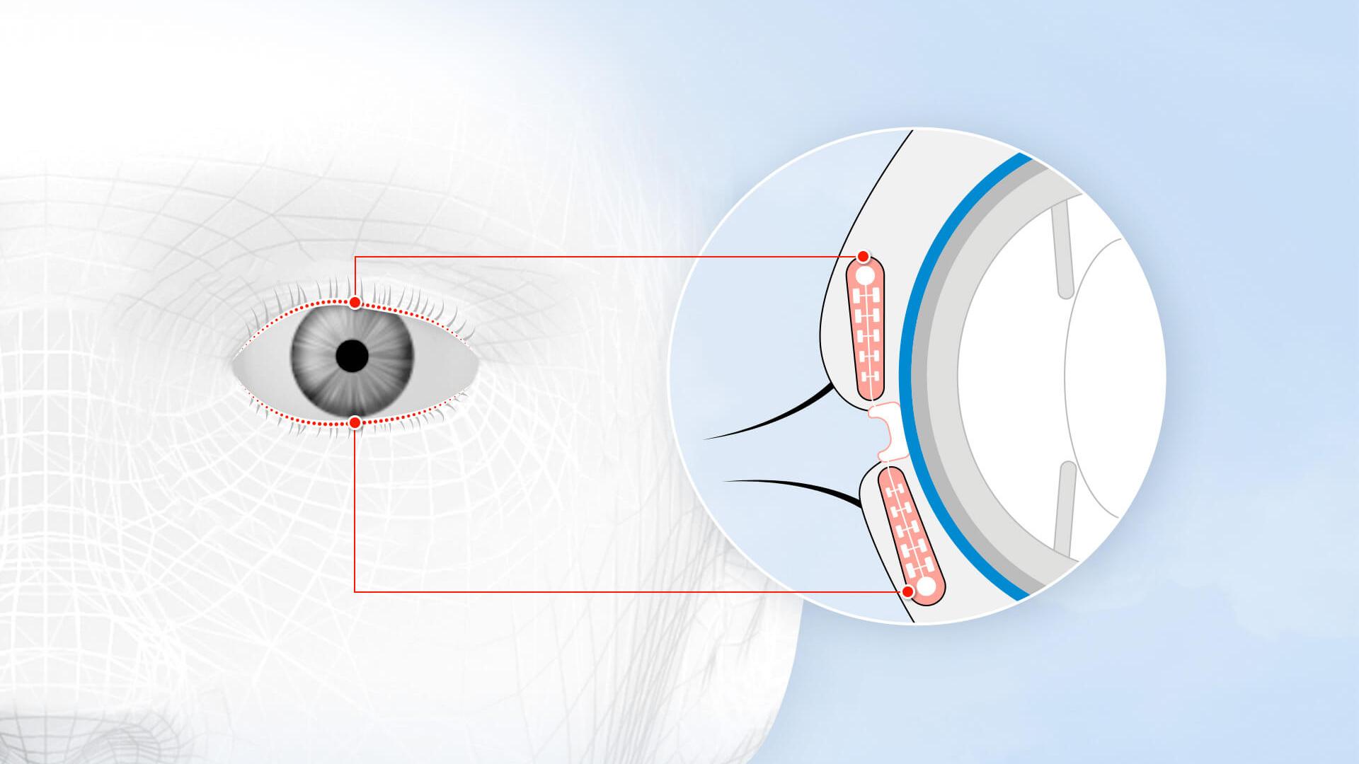 Each eye has around 70 eyelid ducts, or Meibomian glands, which are spread over the upper and lower lids.