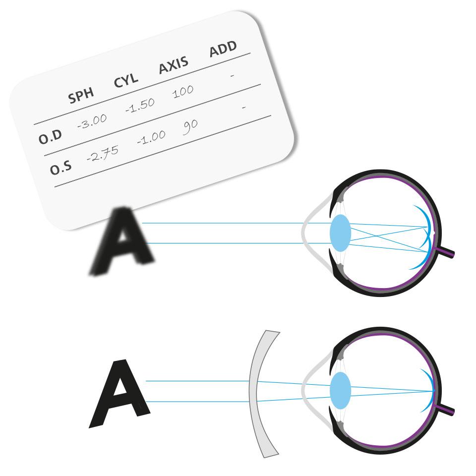 Short sighted glasses prescription sales